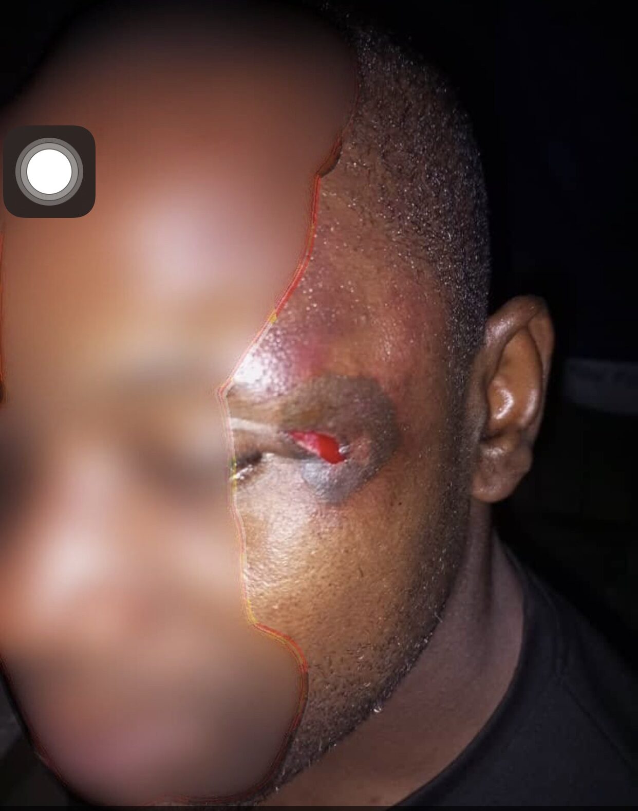 man allegedly stabbed by Policemen.