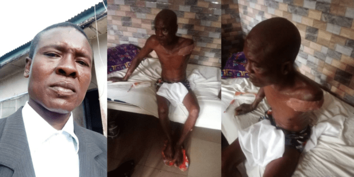 Delta Police Officer shot by criminals loses arm to amputation, incurs N1.2m hospital bill